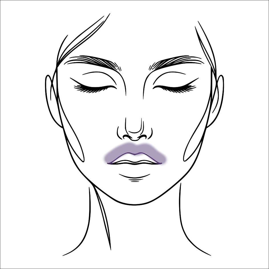 Upper Lip laser hair removal